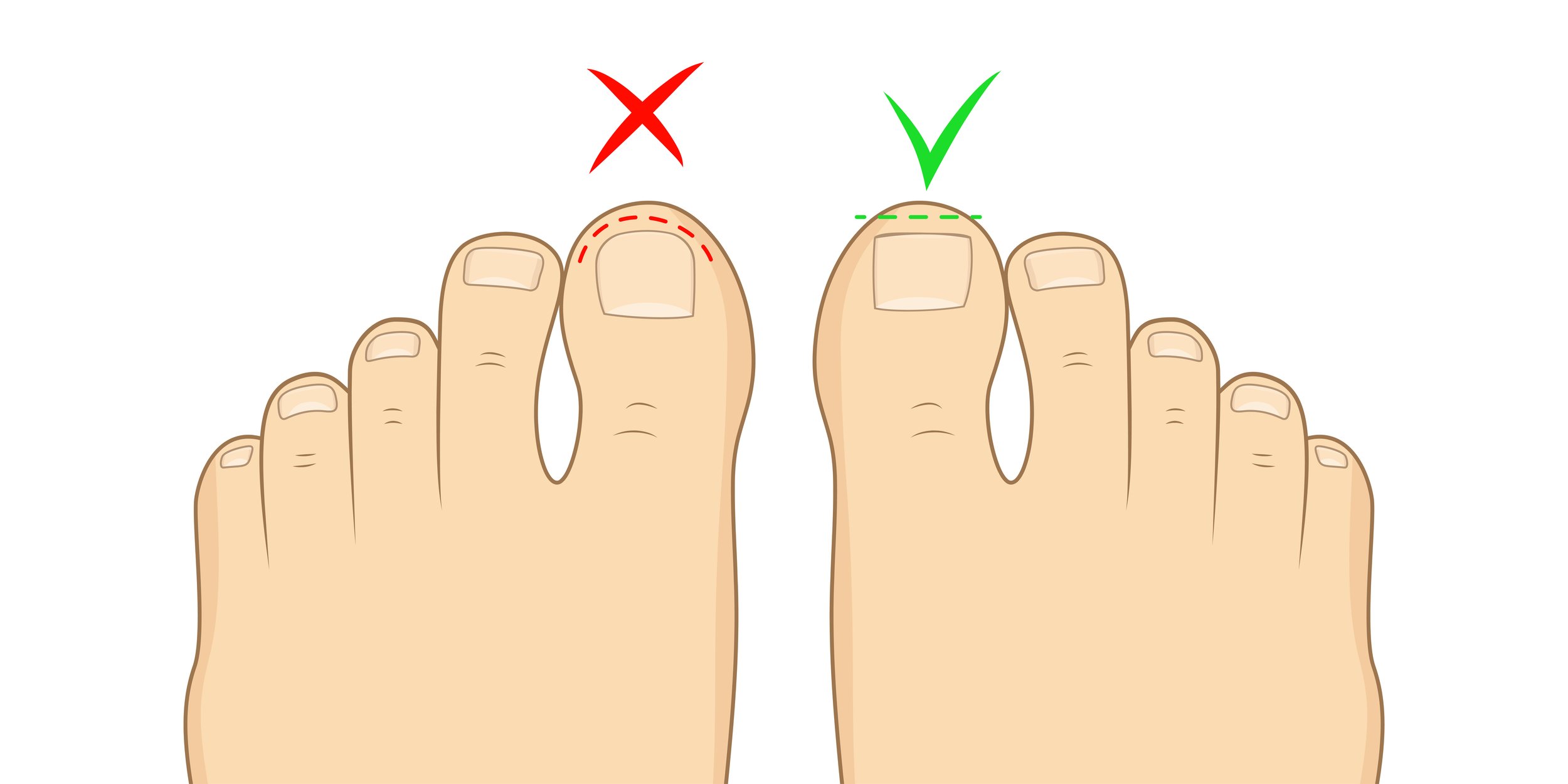 How to sit when cutting toenails the right way find a comfy position easy!