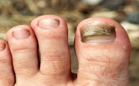 Does Tea Tree Oil Help Stinky Feet? 5 Real Results & How to Use!