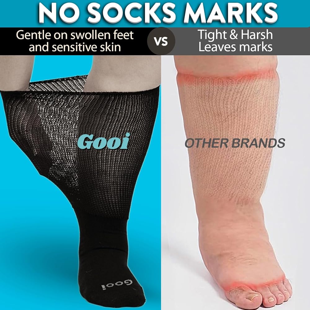 Are Extra Large Socks Worth It for Swollen Feet Honest User Review Inside
