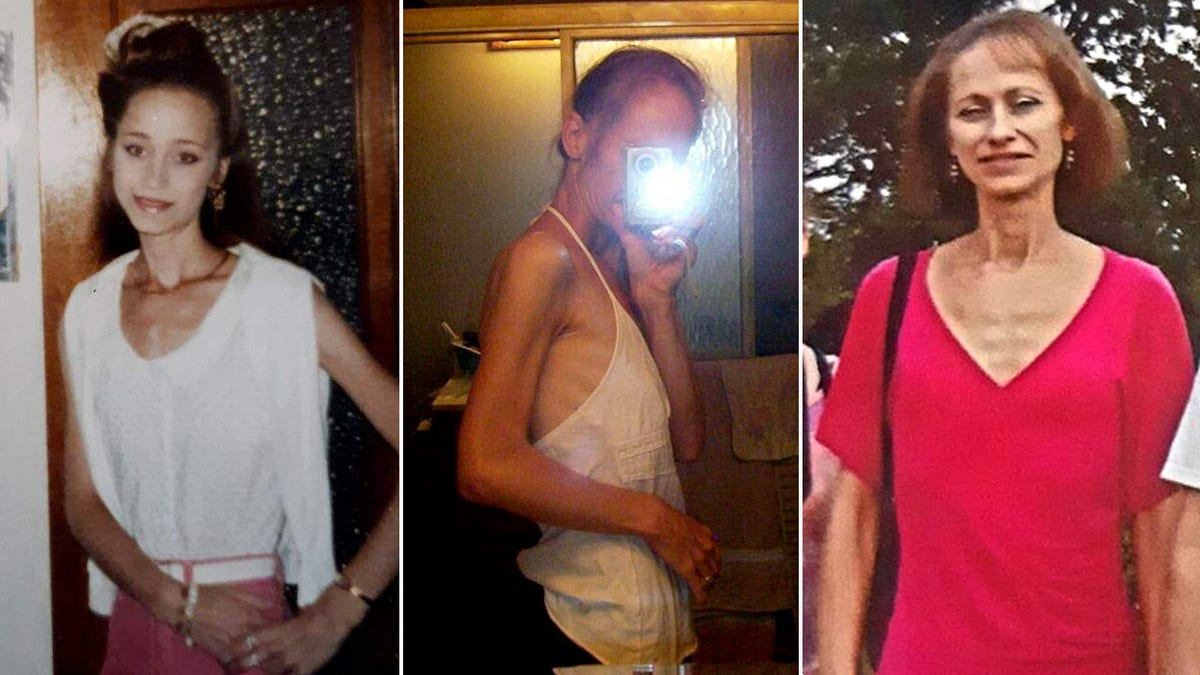 Carnivore Before After Female My Journey Steps And Real Benefits