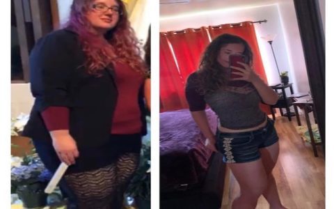 Can you lose 150 pounds without loose skin? Top tips for tight results!